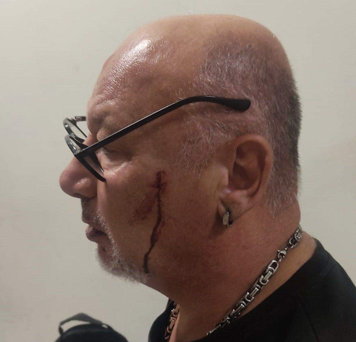 aydinda-gazeteci-kavgayi-goruntulerken-saldiriya-ugradi-2-hFJz4Blr Aydın'da gazeteci kavgayı görüntülerken saldırıya uğradı