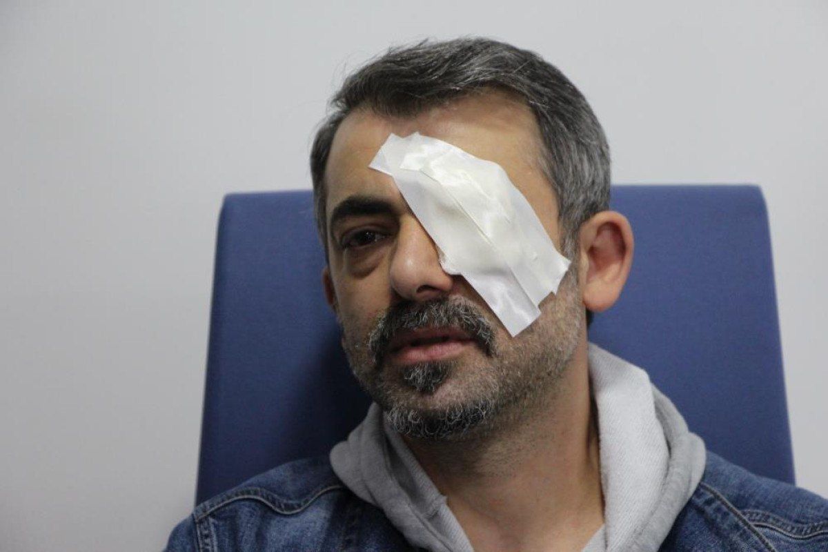 gumushanede-sol-gozune-japon-yapistiricisi-kacti-0-HxiK2xAt Gümüşhane'de sol gözüne Japon yapıştırıcısı kaçtı